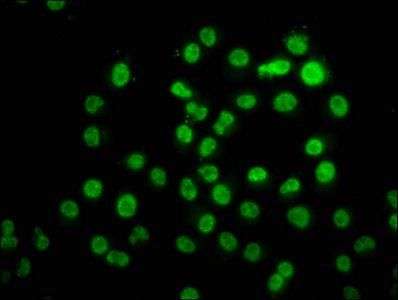 HIST1H3A (Ab-11) antibody