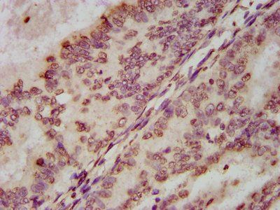 HIST1H3A (Ab-122) Antibody