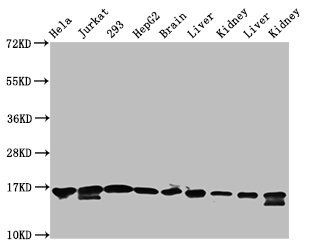 HIST1H3A (Ab-122) Antibody