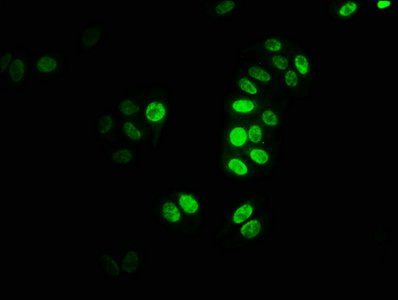 HIST1H3A (Ab-122) Antibody