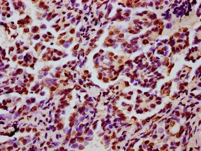HIST1H3A (Ab-122) Antibody