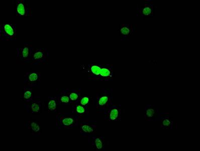 HIST1H3A (Ab-14) antibody