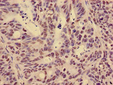 HIST1H3A (Ab-14) Antibody