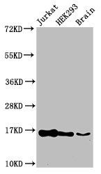 HIST1H3A (Ab-14) antibody