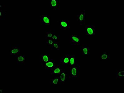 HIST1H3A (Ab-14) antibody