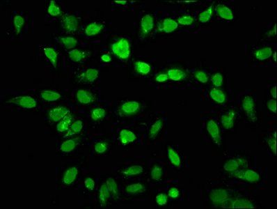 HIST1H3A (Ab-14) antibody