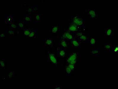 HIST1H3A (Ab-17) antibody