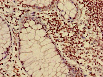 HIST1H3A (Ab-17) Antibody