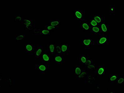HIST1H3A (Ab-17) Antibody
