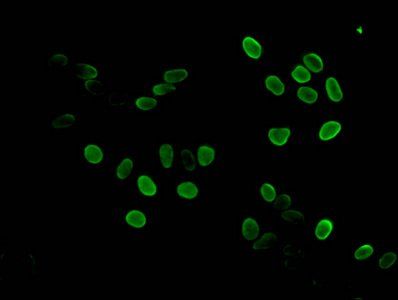 HIST1H3A (Ab-17) antibody