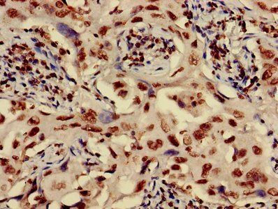 HIST1H3A (Ab-17) Antibody