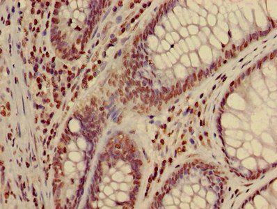 HIST1H3A (Ab-17) Antibody