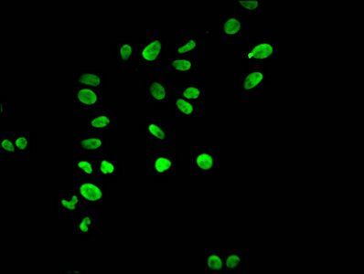 HIST1H3A (Ab-17) antibody