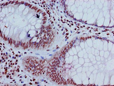 HIST1H3A (Ab-17) Antibody