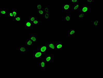 HIST1H3A (Ab-17) antibody