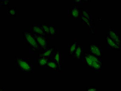 HIST1H3A (Ab-18) Antibody