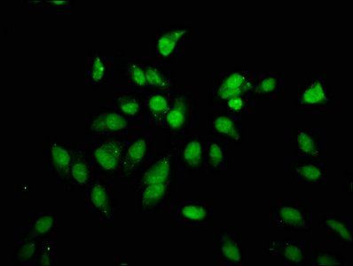 HIST1H3A (Ab-18) antibody