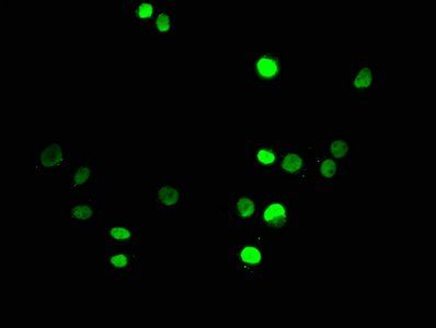 HIST1H3A (Ab-18) antibody