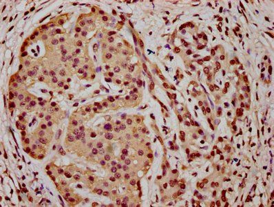 HIST1H3A (Ab-18) Antibody