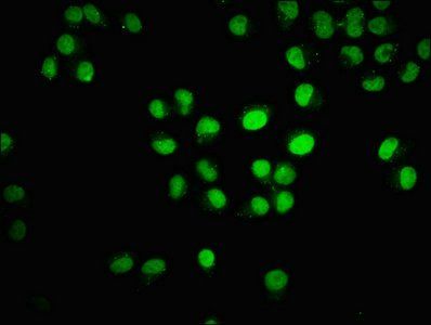 HIST1H3A (Ab-18) Antibody