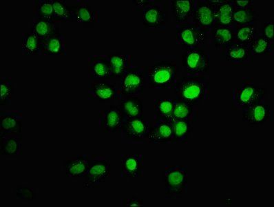 HIST1H3A (Ab-18) antibody