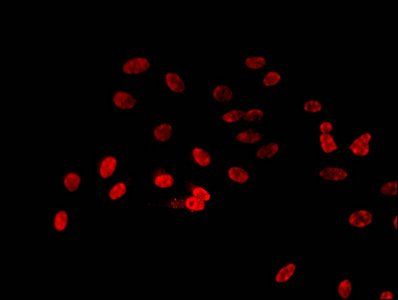 HIST1H3A (Ab-23) antibody