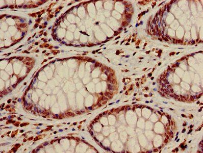 HIST1H3A (Ab-23) Antibody