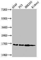HIST1H3A (Ab-23) antibody