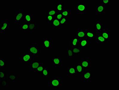 HIST1H3A (Ab-23) antibody