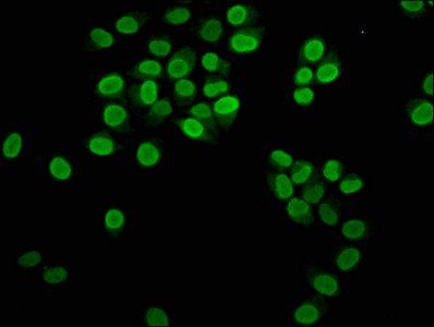 HIST1H3A (Ab-23) antibody