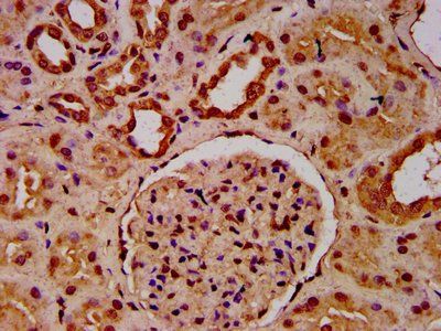 HIST1H3A (Ab-23) Antibody