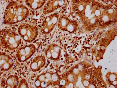 HIST1H3A (Ab-23) Antibody