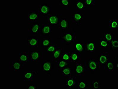 HIST1H3A (Ab-23) antibody