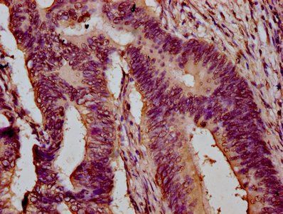 HIST1H3A (Ab-23) Antibody