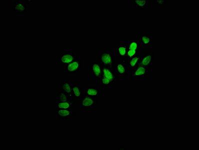 HIST1H3A (Ab-23) antibody