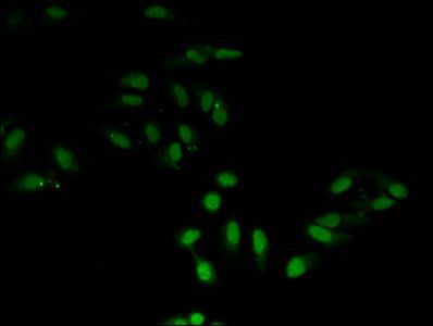 HIST1H3A (Ab-27) Antibody