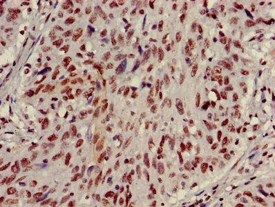 HIST1H3A (Ab-27) Antibody