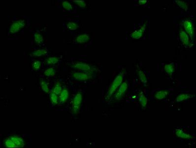 HIST1H3A (Ab-27) Antibody