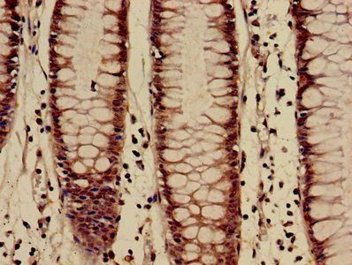 HIST1H3A (Ab-27) Antibody