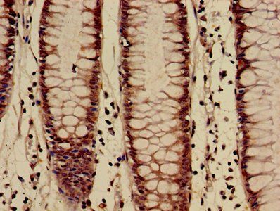 HIST1H3A (Ab-27) antibody