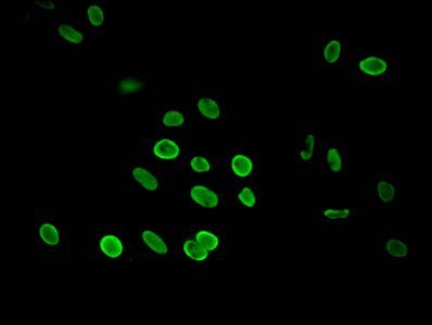 HIST1H3A (Ab-27) antibody