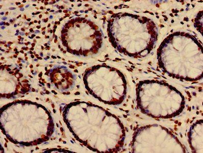 HIST1H3A (Ab-27) Antibody