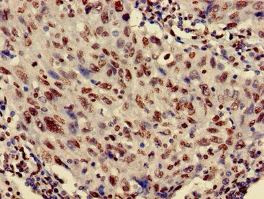 HIST1H3A (Ab-27) Antibody