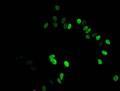 HIST1H3A (Ab-27) antibody