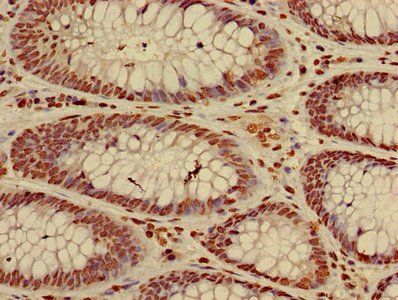 HIST1H3A (Ab-27) Antibody