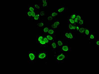 HIST1H3A (Ab-27) Antibody