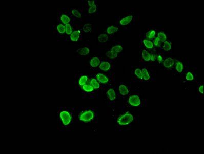 HIST1H3A (Ab-27) antibody