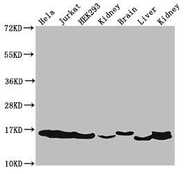 HIST1H3A (Ab-27) antibody