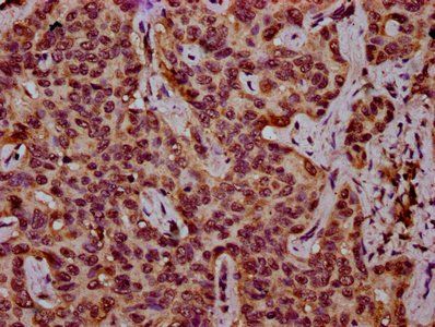 HIST1H3A (Ab-27) Antibody