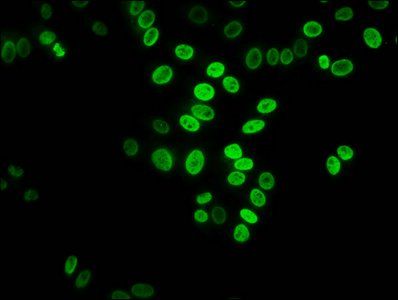 HIST1H3A (Ab-27) antibody